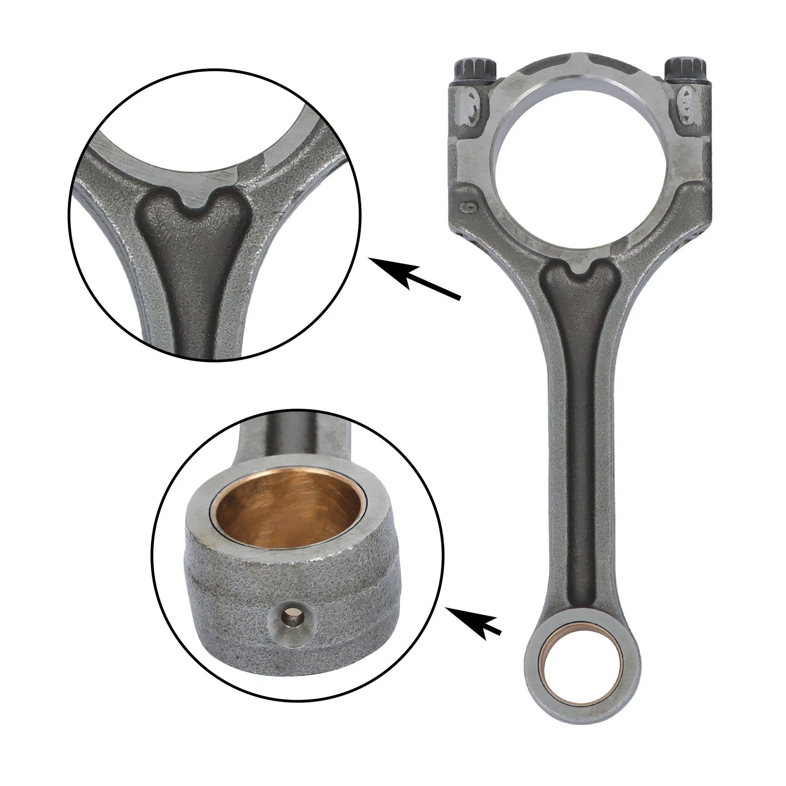 Timing Kit with Rods for Hyundai Kia 1.6L (2014–2021)