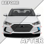 LED Dynamic DRL Fog Light Turn Signal for Hyundai Elantra (2017–2018)