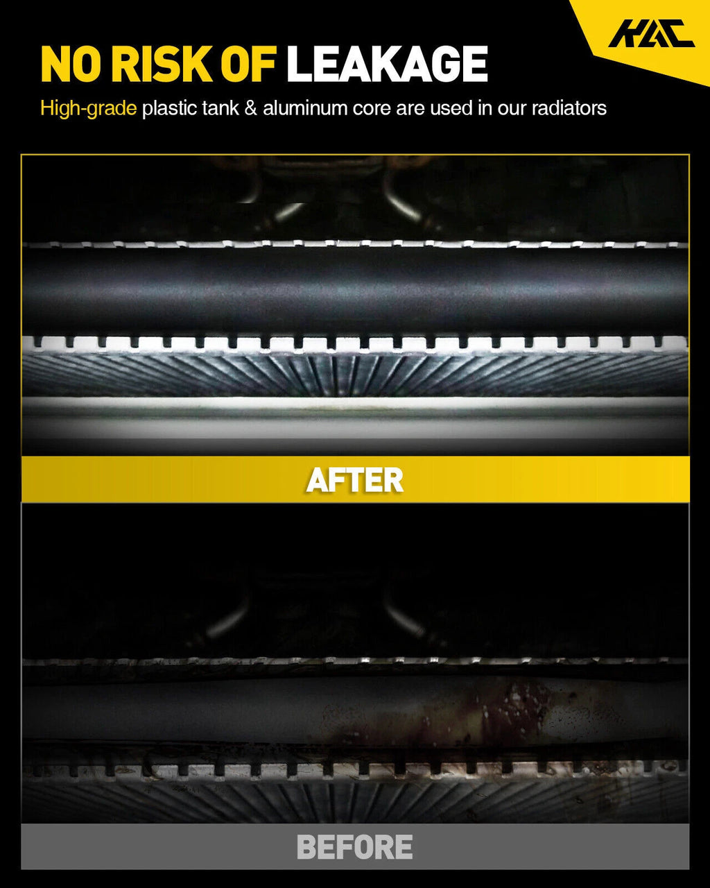 Radiator for Hyundai Elantra (2016–2020)