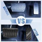 Set of 2 Aluminium Alloy Gas Brake Pedal Pad Covers for Hyundai Elantra (2021–2022)