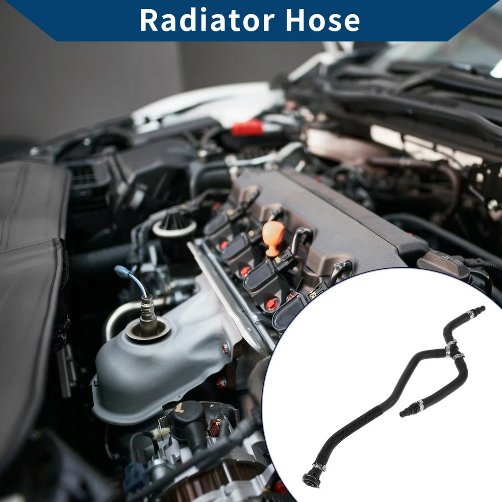 Radiator Hose for Mercedes-Benz C-Class C180 C204 (2013-2024)