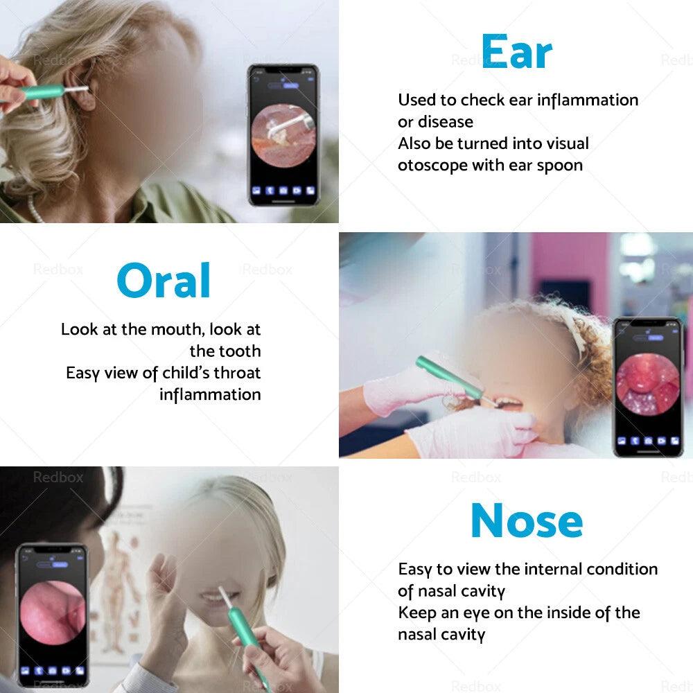 Ear Wax Remover Camera Cleaning Pick Tool with LED Light